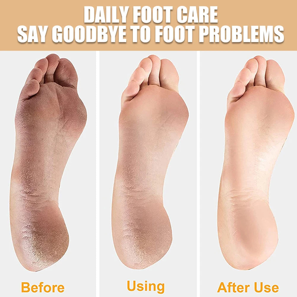 Doppelseitige Fußfeile – Professionelle Raspel für weiche, gepflegte Fersen & Fußhaut